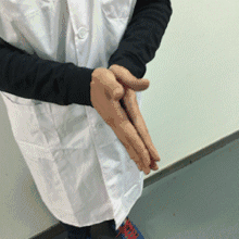 「中醫養生」氣虛體質分兩種，中醫教你如何調理