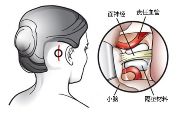 為什麼醫生告訴我左眼皮跳跳不是好事？