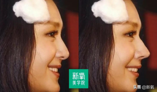 短臉+翹鼻是驚豔絕配？