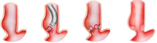 胃不舒服、反酸、燒心…試試這個新妙招,有用 胃不舒服、反酸、燒心…試試這個新妙招,有用