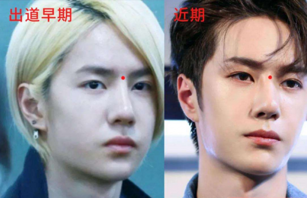 明星“假鼻子”大PK，誰的一捏就扁，誰的是“人間阿凡達”？