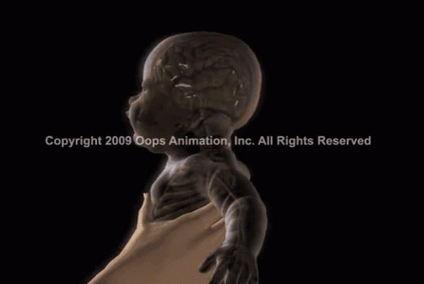 好心哄娃，卻把7個月寶寶哄成腦癱，這些哄娃方式，家長別做了