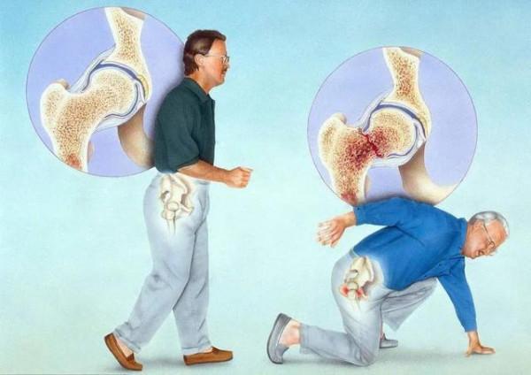 老年人為啥摔一跤就骨折？50歲後，2種肉請捨得吃，讓骨骼更健康