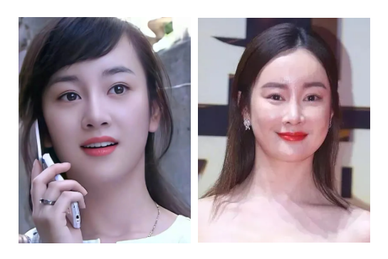 明明擁有媽生美貌，卻變成&OpenCurlyDoubleQuote;整容怪物&rdquo;？她們何苦啊