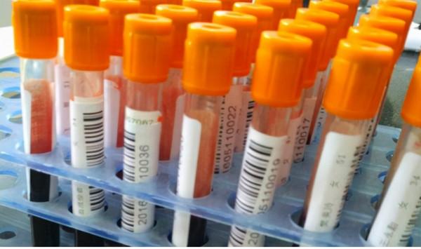 你身體裡的甘油三脂是從哪來的？又去了哪？來去為什麼會失衡？