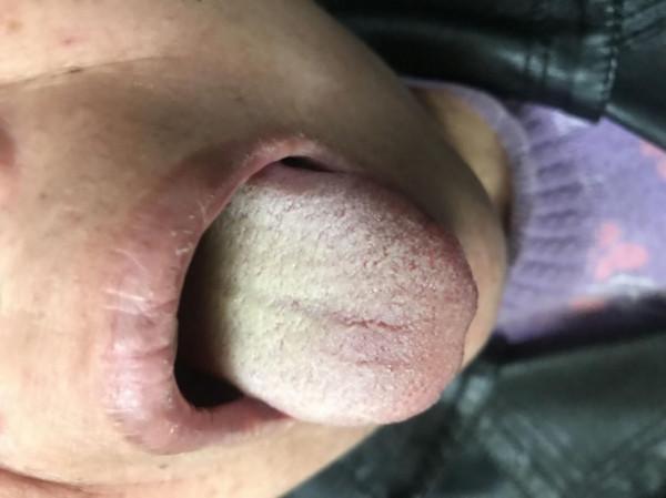 醫案實踐分享（第17期）