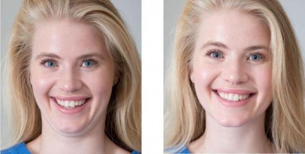 虛胖和真胖有哪些不同？身上3個部位的變化，或許能提醒你