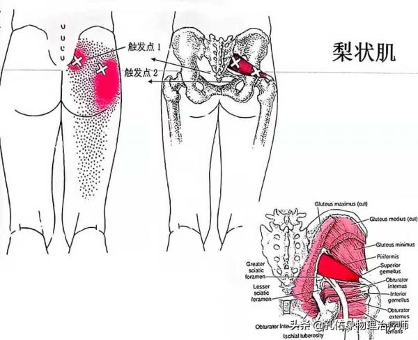 腰腿疼，竟是骨盆惹的禍！還在整天拿著腰椎看嗎？一文告訴您