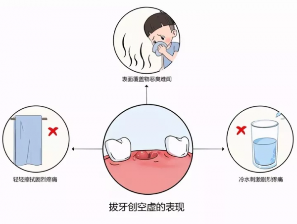 老年人牙疼是怎麼回事? 老年人牙疼是怎麼回事?