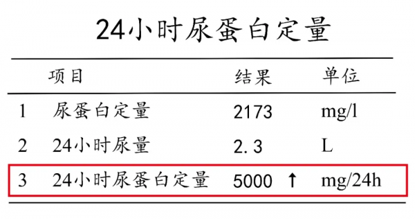 為什麼腎不好的人,容易水腫?腳腫、眼睛腫... 為什麼腎不好的人,容易水腫?腳腫、眼睛腫...