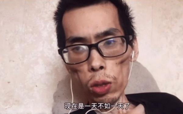 34歲抗癌博主離世,一年時間彷彿走完了一生:生命的底色註定悲涼 34歲抗癌博主離世,一年時間彷彿走完了一生:生命的底色註定悲涼