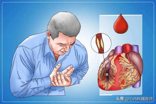 45歲男子心梗離世!醫生說:他有3次救命機會,可惜都錯過了 45歲男子心梗離世!醫生說:他有3次救命機會,可惜都錯過了