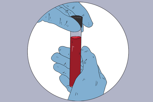 老實說：體檢表上的幾種病，根本不用治療，別陷入自我恐慌