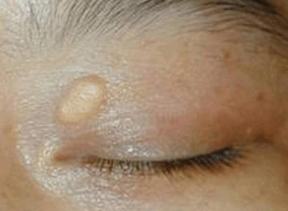 這幾種食物是公認的&OpenCurlyDoubleQuote;降脂好手&rdquo;，平時多吃點，讓血管柔軟又暢通