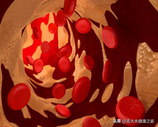 長期服用阿司匹林和他汀，是在治療腦梗死嗎，真正目的是什麼？