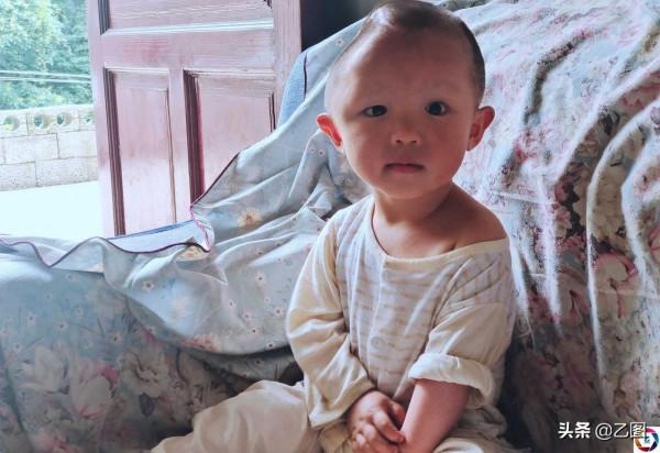 男孩發生意外失去半個腦殼，父親自責，只想給孩子一個正常的腦袋