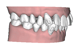 小仙女告訴你，改變牙齒真的可以改變臉型