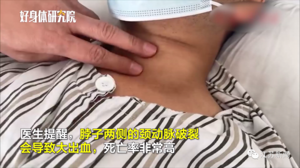 男子甩了幾下頭，竟把頸動脈甩破了！醫生：這些行為很危險