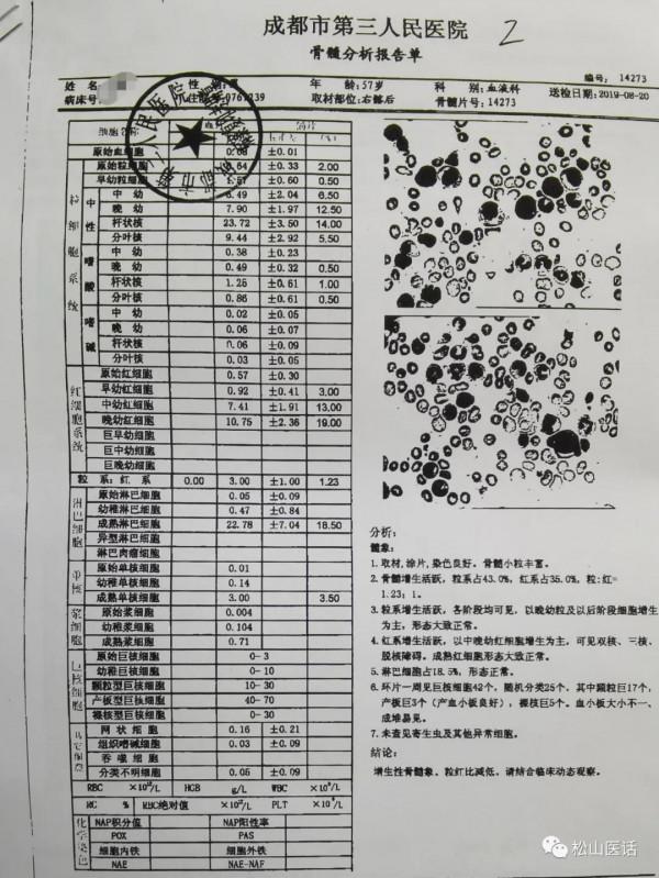 救人一命,勝造七級浮屠!搶救骨髓增生異常綜合徵輸血依賴性貧血 救人一命,勝造七級浮屠!搶救骨髓增生異常綜合徵輸血依賴性貧血