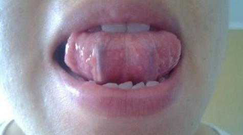 白天調陰陽,晚上安神!教你3個治療失眠的調理小方 白天調陰陽,晚上安神!教你3個治療失眠的調理小方