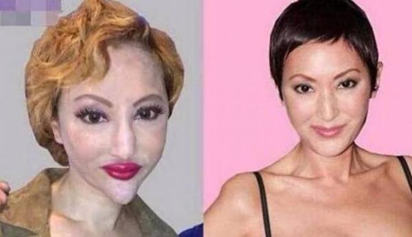 盤點那些被整容毀掉的明星，哪一個覺得可惜？