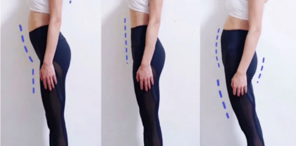 最全腿型解析都在這,腿不直的人對號入座 最全腿型解析都在這,腿不直的人對號入座