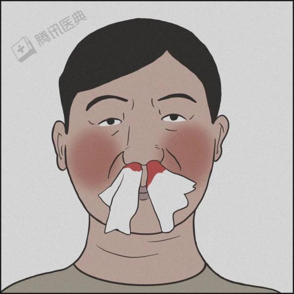 魚刺卡喉吞飯、流鼻血仰頭……別再這樣“自殺式”急救了! 魚刺卡喉吞飯、流鼻血仰頭……別再這樣“自殺式”急救了!