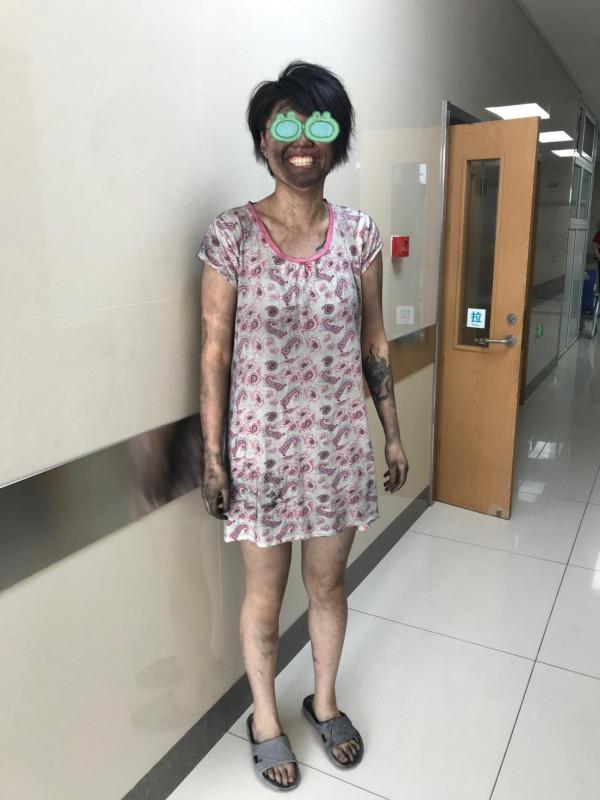 逃出火場的我十分亢奮，但接著就被塞進ICU淬火了