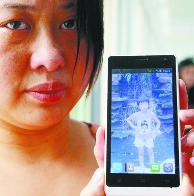 6年前，那個患上罕見怪病的8歲女孩，移植“豬皮”後成功治癒出院