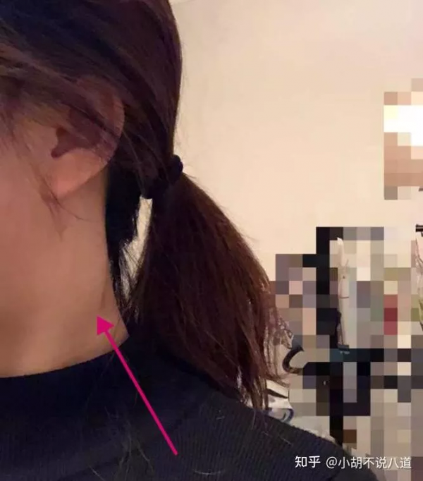 2個月拖成晚期，我錯過了這些黃金癌症警示