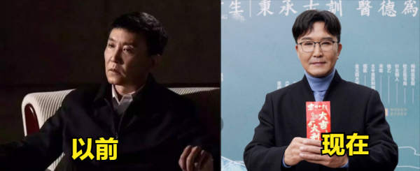 臉腫，嘴歪，笑不出來，整容後的&quot&semi;矽膠臉&quot&semi;把這9位好演員，害慘了