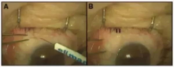 這層“面板”長了“皺紋”惹來了老淚縱橫