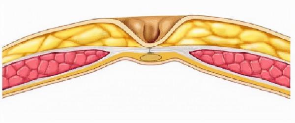 肚臍眼後面通向哪裡？| 趣問萬物
