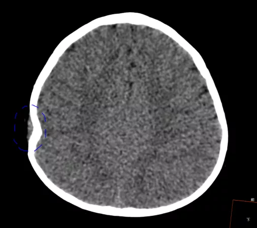 一份放射科醫師的值班日記，告訴你兒童意外傷害有多可怕