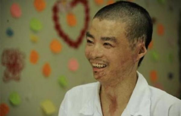 兵哥哥捨身救44人，身體燒傷達90%，住院時女孩喂水後修成正果