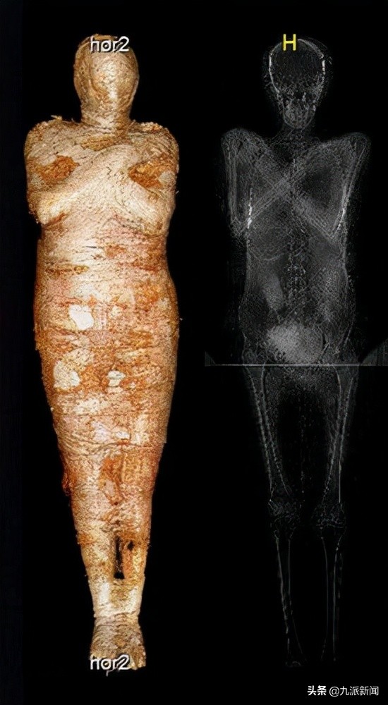 第一個古埃及懷孕木乃伊腹中發現完好胎兒，未出生已有兩千歲