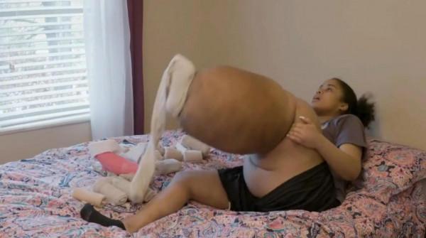 美國女子患先天疾病一條腿重達80斤,卻成為當地的網紅和時裝模特 美國女子患先天疾病一條腿重達80斤,卻成為當地的網紅和時裝模特