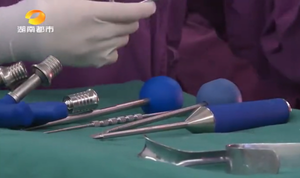 11歲“麻花女孩”李潔智力低於2歲，後背植入30顆螺釘，後來怎樣