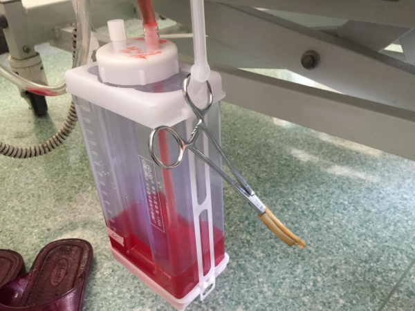 肺癌患者伴有胸腔積液，如何延長患者壽命，提高生活質量？