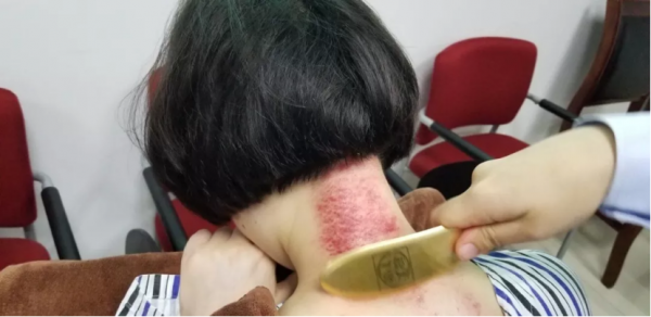 您是哪種感冒?對症治療很重要 您是哪種感冒?對症治療很重要