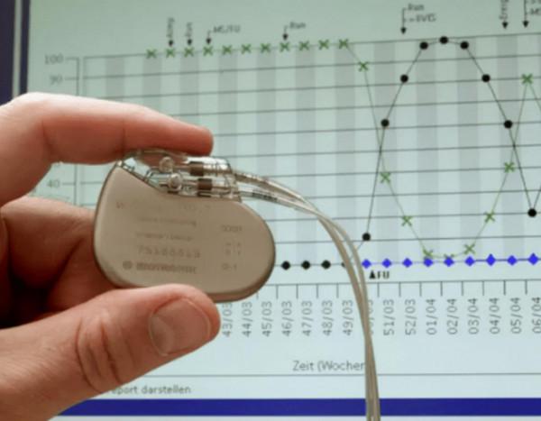 駭客巴納拜:讓ATM吐錢,公開心臟起搏器漏洞前離奇死亡 駭客巴納拜:讓ATM吐錢,公開心臟起搏器漏洞前離奇死亡