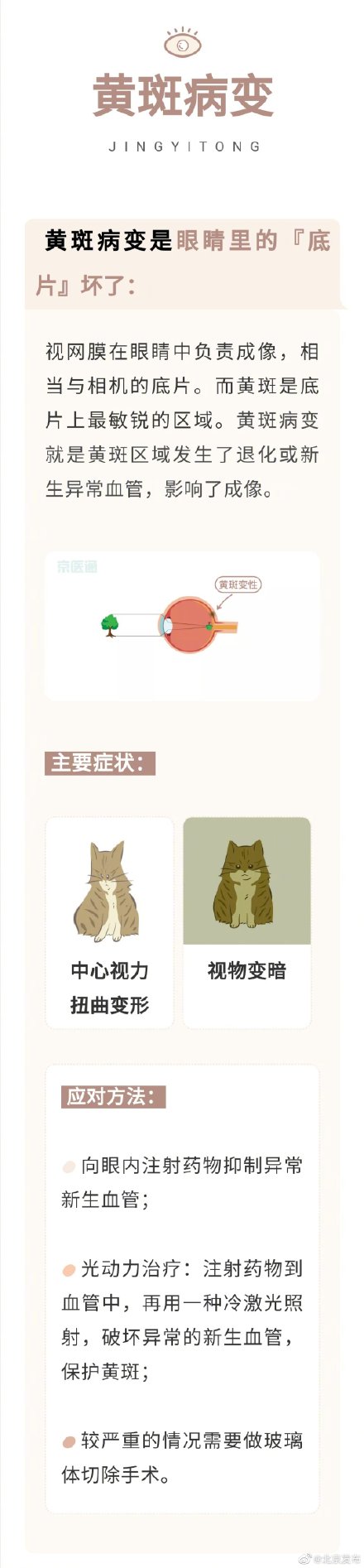 近視、散光、老花眼……到底有什麼不同，眼科醫生一句話告訴你