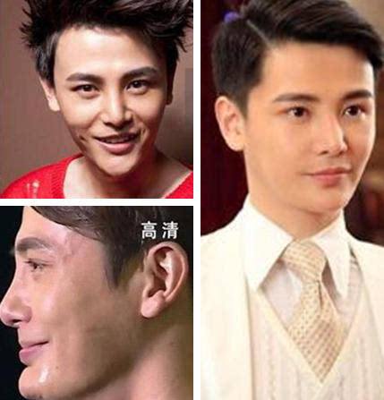 內娛“假鼻子”大PK，誰的假到逆天，誰的越整越殘？