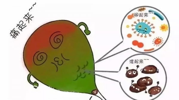 膽囊控訴：主人！膽結石都是你自己造成的，不要甩鍋給我