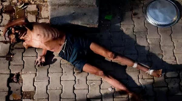 如何辨別身邊人是否吸毒?瞭解一下他們的身體特徵:臉上長痘、未老先衰…… 如何辨別身邊人是否吸毒?瞭解一下他們的身體特徵:臉上長痘、未老先衰……