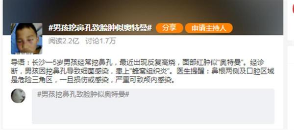 男孩常挖鼻孔臉腫似奧特曼，醫生提醒：經常用手摳挖鼻子，當心引起鼻腔感染