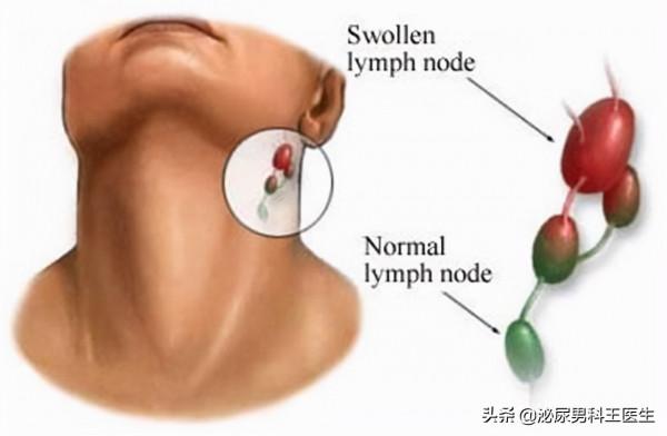 有泡沫尿就是腎臟有問題嗎? 有泡沫尿就是腎臟有問題嗎?
