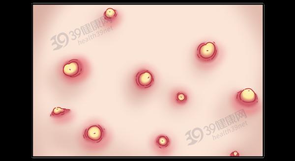 中醫2個藥材，有效補氣排毒，“體毒”沒了，便秘等症狀就緩解了