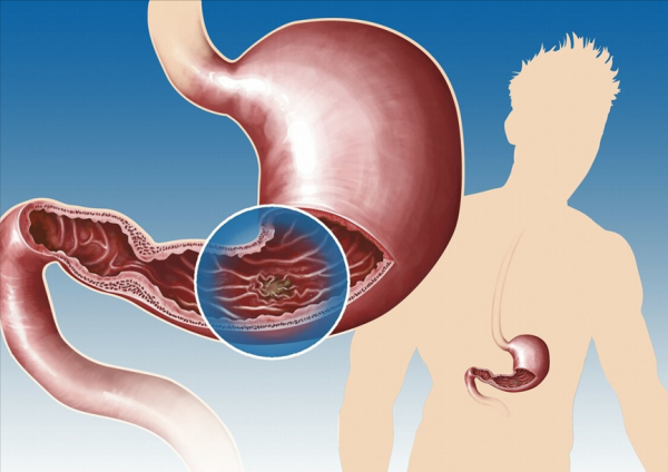 吃香蕉是養胃還是傷胃?提醒:不想胃受傷,儘量少吃這3物 吃香蕉是養胃還是傷胃?提醒:不想胃受傷,儘量少吃這3物