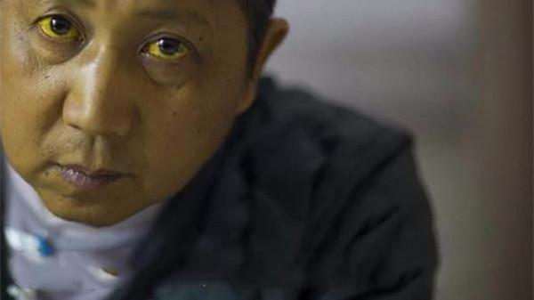 肝病會“上臉”？提醒：肝不好，臉上或許會出現3個“標誌”